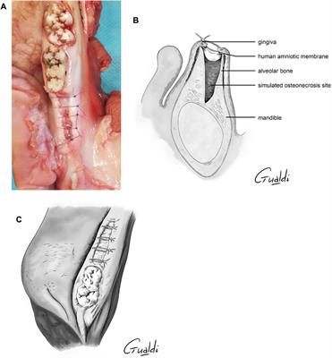 Human amniotic membrane application in oral surgery—An ex vivo pilot study